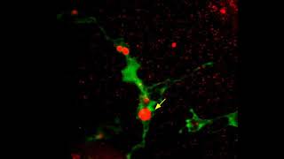 Microglial acidification [upl. by Reamonn947]