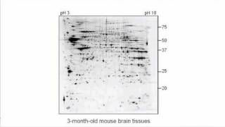 2D Gel Electrophoresis Applications [upl. by Allix982]