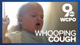 Sound of whooping cough [upl. by Aenotna]