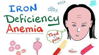 Iron Deficiency Anemia  All you need to know  Causes Symptoms Diagnosis Treatment [upl. by Yramanna527]