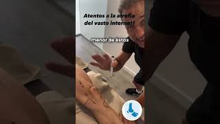 Lesiones de Rodilla Clave del Vasto Interno en la Recuperación y Prevención fyp viral parati [upl. by Alihet293]