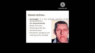 Acromegaly physiotherapy physiology youtube shorts [upl. by Aldas430]