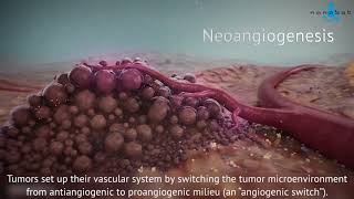 Tumor growth  3D medical animation [upl. by Diena503]