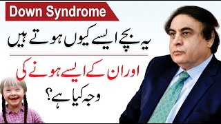 What Is Down Syndrome  Causes Signs amp Symptoms And Treatment  By Dr Khalid Jamil Akhtar [upl. by Iiette]