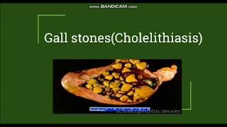 Cholelithiasis  Gallstones Pathogenesis amp Morphology [upl. by Nacnud]