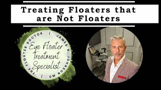 Treating Floaters Not Usually Considered Floaters [upl. by Liarret]