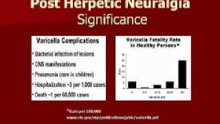 Pain Didactic Herpes Zoster and PHN  Pt 3 [upl. by Orban]