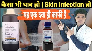 Betadine solution uses in hindi  Povidon iodine solution [upl. by Rees846]