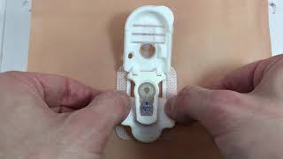 Gastrostomy Button Securement Device [upl. by Eenet]