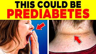 ALERT 11 SIGNS you HAVE PREDIABETES and DON’T KNOW IT  106 [upl. by Recha]