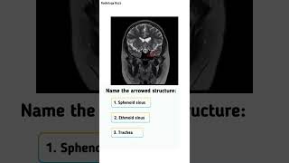 🔍 Anatomy Quiz🔍 Comment your answer belowRadiologyBuzz SinusAnatomy RadiologyQuiz [upl. by Aralk]