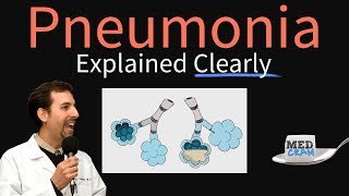 Pneumonia Explained Clearly by MedCramcom [upl. by Leorsiy]