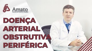 Doença Arterial Obstrutiva Periférica [upl. by Belldame]