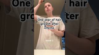 One Year of Hair Growth Post Chemo [upl. by Arrac]