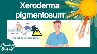 Xeroderma pigmentosum  What is the main cause of xeroderma pigmentosum  treatment of XP  USMLE [upl. by Manda]