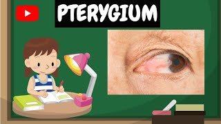 Pterygium  Learn with Neha [upl. by Atinad]