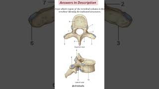 identify the parts of vertebrae humananatomy [upl. by Anatolio]