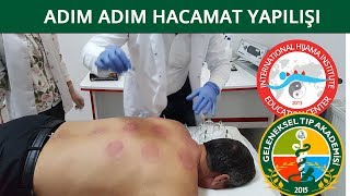 Hacamat Sırları3 Ön Vakumlama incelikleri DrN Süleyman Gök [upl. by Forland]