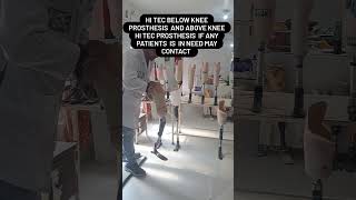 Hi tec below knee prosthesis above knee prosthesis if any patient is in need may contact [upl. by Mayman981]