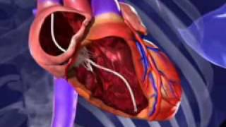 The Defibrillator Device That Can Resynchronize Your Heart [upl. by Letnoj325]