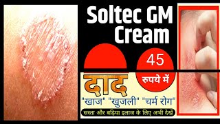 Ringworm Fungal Infection Treatment In Hindi Fungal Infection Cream Soltec GM cream दाद की दवा [upl. by Marve]