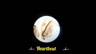 Daphnia🪲🪲 Heart beat 💓💗  Zooplankton  Under Microscope 🔬🔬 Water fleas 🪲 [upl. by Guthrie]