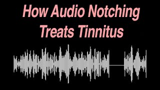 How Audio Notching Treats Tinnitus [upl. by Rehc]