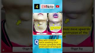 Neck Cystic Leision doctor medical nursing [upl. by Omle]