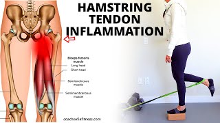 Hamstring Tendinopathy Best Relief Exercises Causes and How to Heal Tendinitis [upl. by Raybourne]