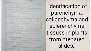 Identification of parenchyma collenchyma and sclerenchyma tissues in plants from prepared slides [upl. by Fillbert]