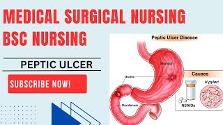 pepticulcer bscnursing peptic ulcer kya hota hai full notes \\ AIIMSNORCET03 youtubevideo [upl. by Wallford]