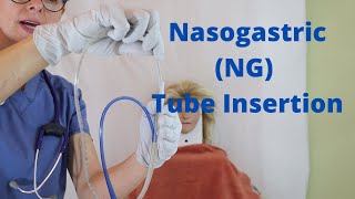 Nasogastric NG Tube Insertion [upl. by Drhacir472]