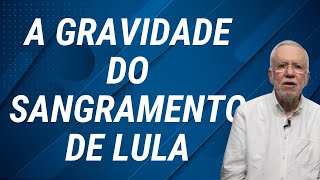 Governadores se unem contra retirada de seus poderes  Alexandre Garcia [upl. by Ceevah]