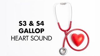 S3 and S4 Gallop  Heart Sounds  MEDZCOOL [upl. by Setsero]