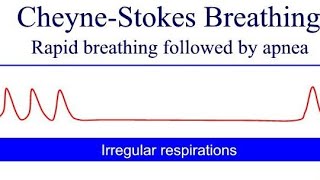 Cheyne Stokes Breathing Pattern  general diseases in human body Cheyne Stokes Kussmauls Biots [upl. by Tillman273]