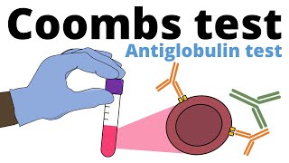 Coombs Test antiglobulin test [upl. by Inobe]