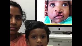 Cleft Lip Surgery  Before and After Video [upl. by Hannus]