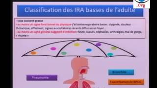 Cas Clinique sur la Pneumonie  Première Partie [upl. by Magdau]