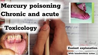 Mercury poisoning metallic poisons Toxicology [upl. by Utter]