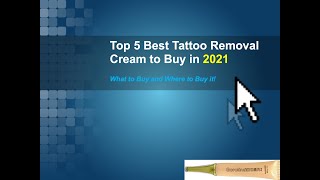 Top 5 Best Tattoo Removal Cream to Buy in 2021 [upl. by Nagn]