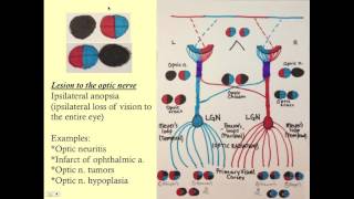 Neuroopthalmology  CRASH Medical Review Series [upl. by Aitrop284]