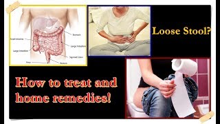 Loose Stool – Causes Treatment Home Remedies [upl. by Tletski]