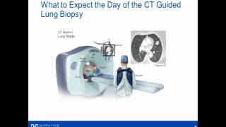 CT Lung Biopsy [upl. by Okika983]