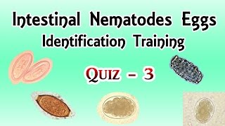 Intestinal Nematodes Eggs Identification Training Quiz 34 [upl. by Pleasant]