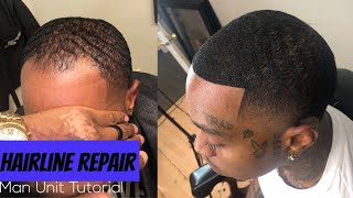 SHOCKING TRANSFORMATION Must see Hairline Repair Service  Best Man Unit Tutorial [upl. by Boyden1]