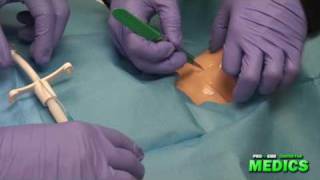 Surgical Cricothyrotomy by the Paramedic Intern [upl. by Meadow]