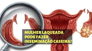 Quem é LAQUEADA pode fazer INSEMINAÇÃO CASEIRA [upl. by Sybley176]