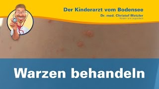 Warzen behandeln  Der Kinderarzt vom Bodensee Warzen 22 [upl. by Ellekcim2]