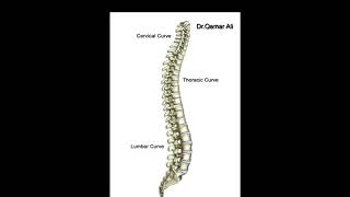 Scheuermann’s disease causes symptom diagnosis xray treatment [upl. by Lednahc]