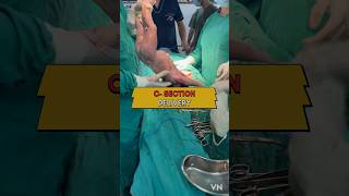 CESAREAN BIRTH 🤱🩺🏥 ankur maitrika hospital NEWBORN CARE JAMMU [upl. by Aneehs]